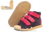 8-1014B fioletowe buty-sandałki-kapcie profilaktyczne ortopedyczne przedszk. 26-30  AURELKA - galeria - foto#1