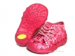 03-130P020 SPEEDY różowe kapcie-buciki obuwie wcz.dziecięce buty dla dziecka Befado - galeria - foto#1